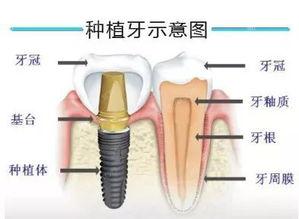 2024湛江五大公办和私立口腔医院排名，种草湛江种植牙靠谱环境好的牙科