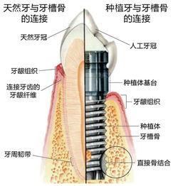上海评价好的十大口腔医院排名，种植牙技术好评价靠谱的是这十家