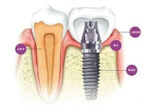 眉山2024种植牙三大口腔医院排名，这三家牙科正规评价好值得推荐