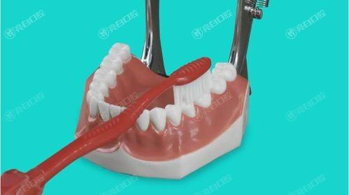 新版河南郑州优尔雅口腔口腔项目手术价格表 半口种植牙50000+补牙300+拔牙300+
