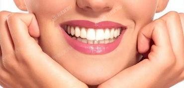 瞅瞅浙江温州徐盛口腔口腔项目收费标准 牙齿美白100|地包天矫正15000