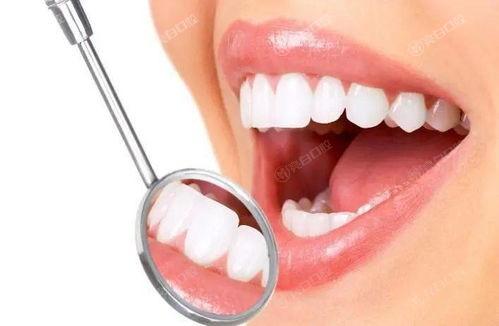 分享江苏苏州昆山玖果口腔口腔项目价格一览表 整牙、全瓷牙、牙周治疗、活动假牙部分有折扣
