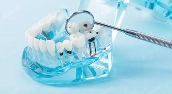 分享江苏苏州昆山玖果口腔口腔项目价格一览表 整牙、全瓷牙、牙周治疗、活动假牙部分有折扣