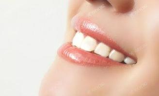 成都瓷倍健全瓷牙有名的口腔医院排名 上榜均是成都瓷倍健全瓷牙好的医院可挂号网上预约