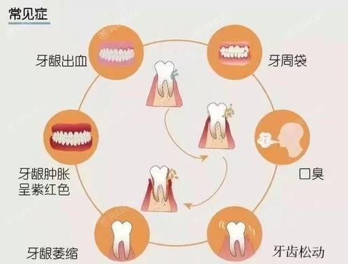 看一看广东广州玉雅口腔诊所口腔项目价格表 做根管治疗200/活动义齿800挺便宜